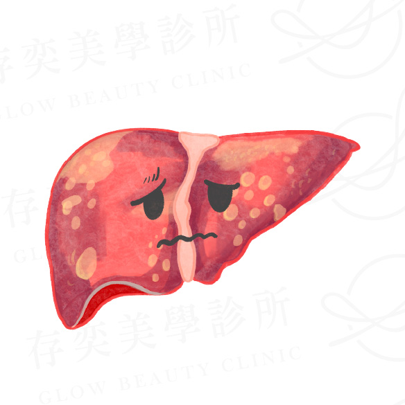 三種脂肪肝症狀v2_輕度脂肪肝
