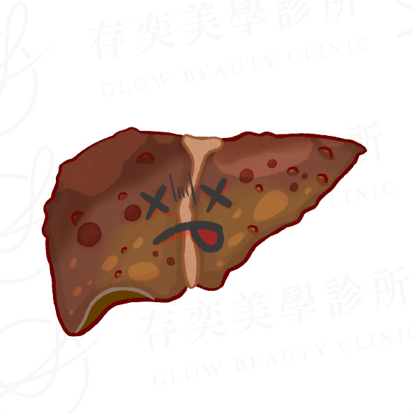三種脂肪肝症狀v2_重度脂肪肝