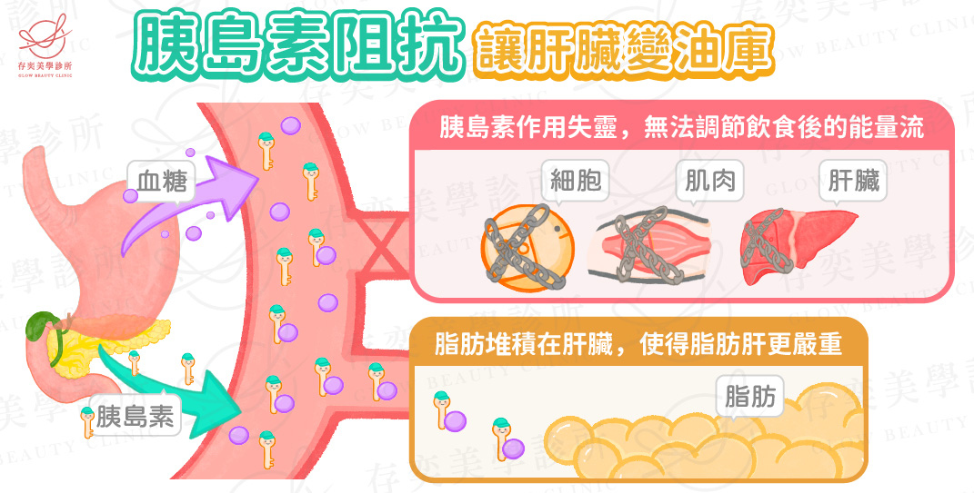 胰島素阻抗讓肝臟變油庫v8