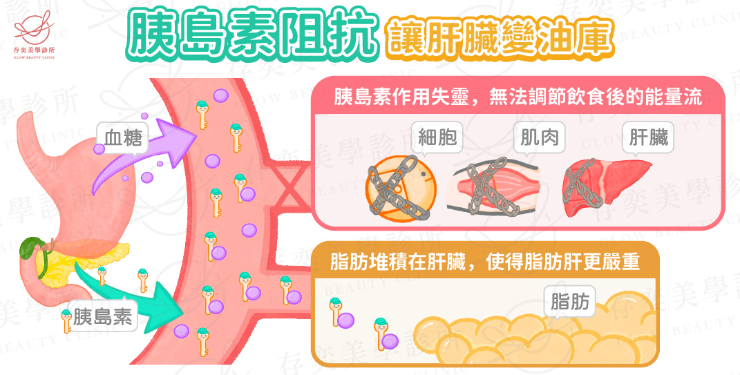 胰島素阻抗讓肝臟變油庫v9