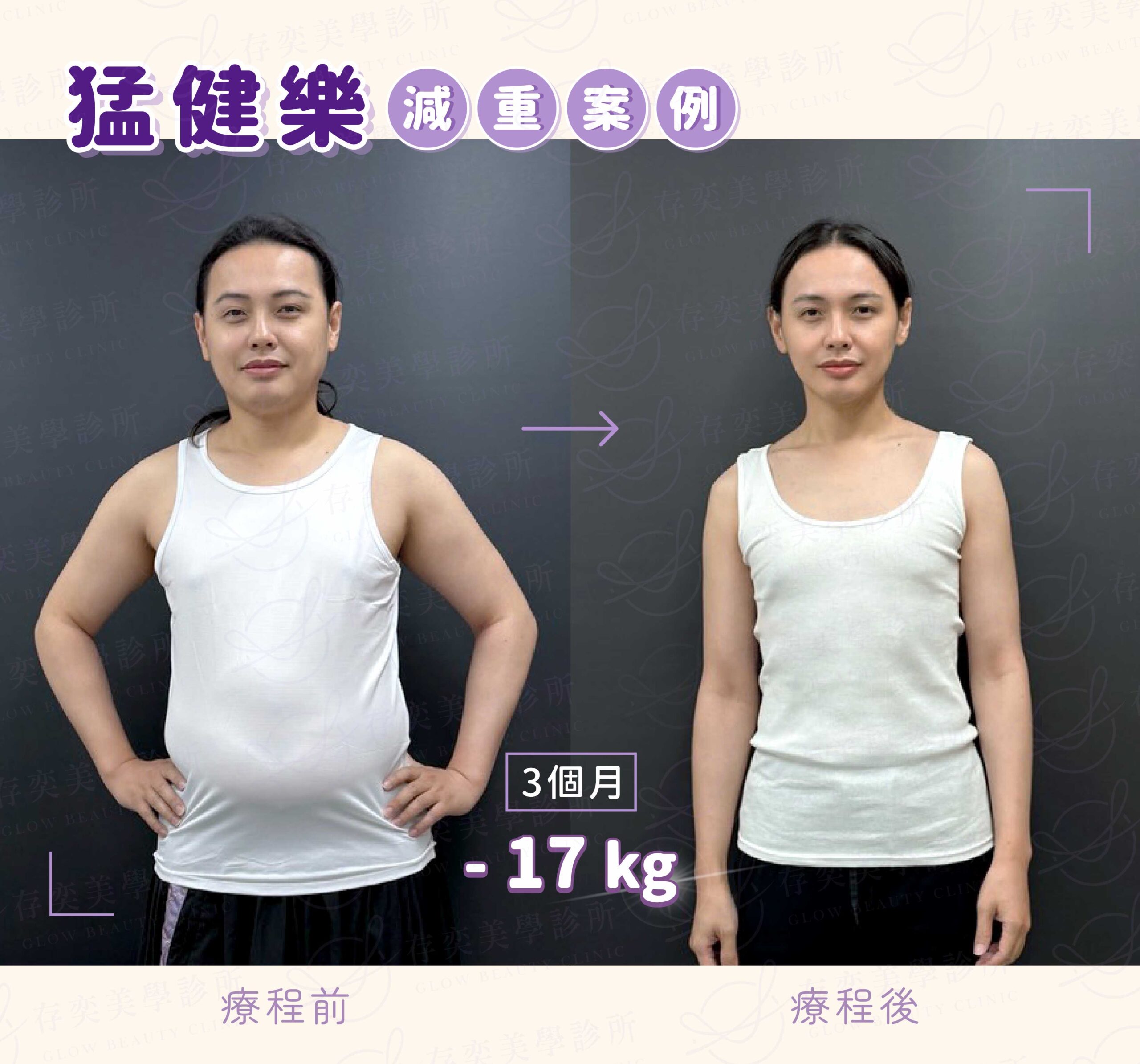 猛健樂減重筆減重案例-02