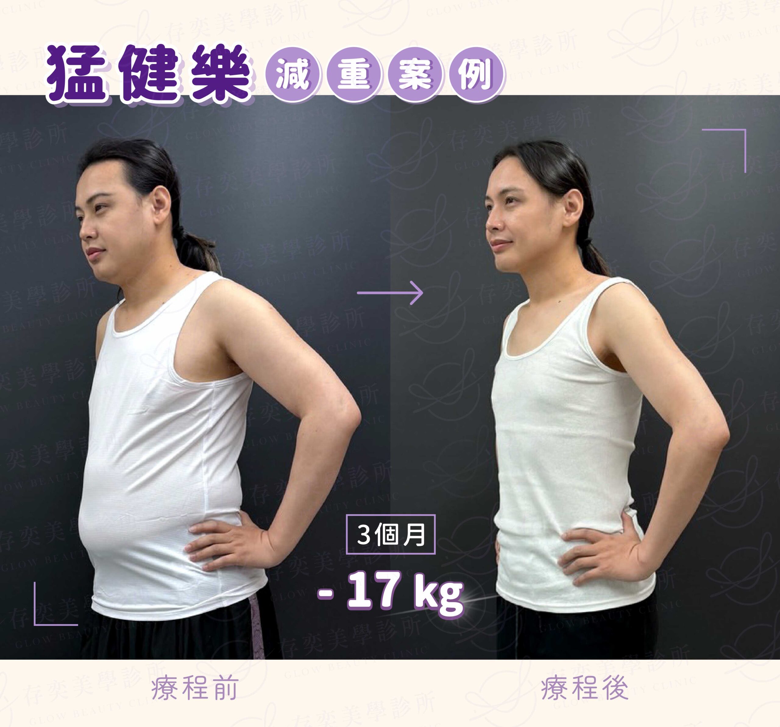 猛健樂減重筆減重案例