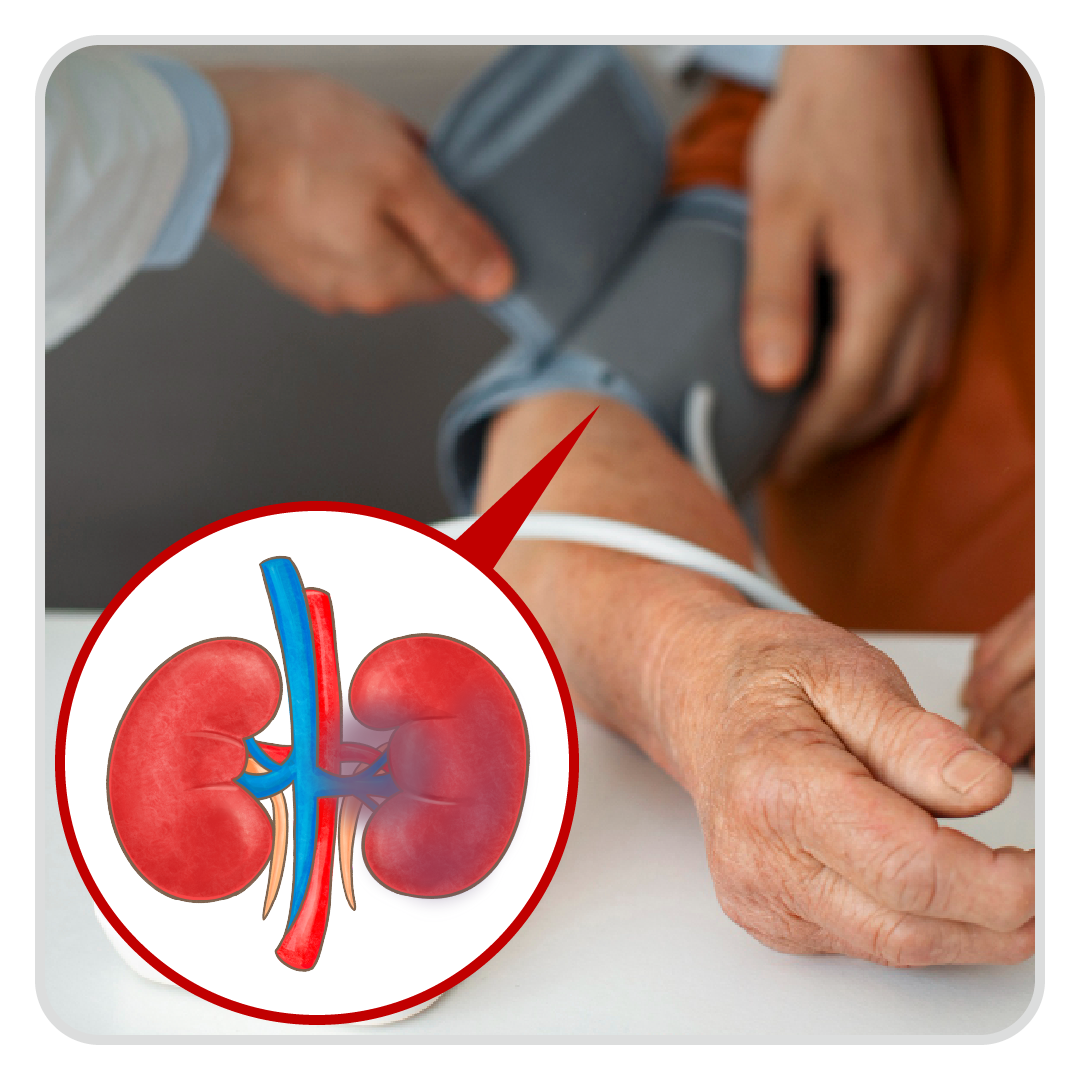 血管堵塞在哪_腎→高血壓