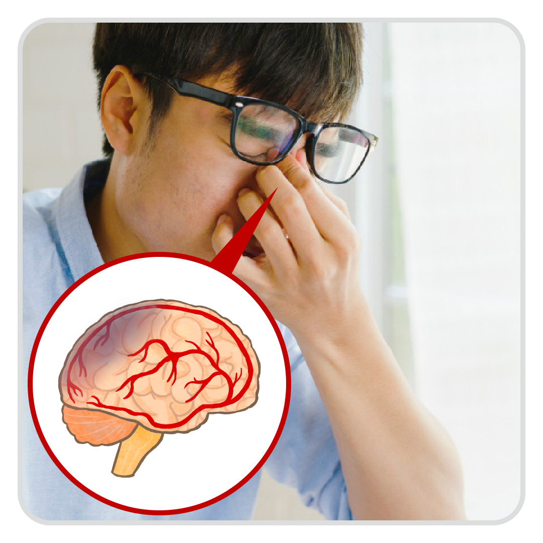 血管堵塞在哪_腦部→中風