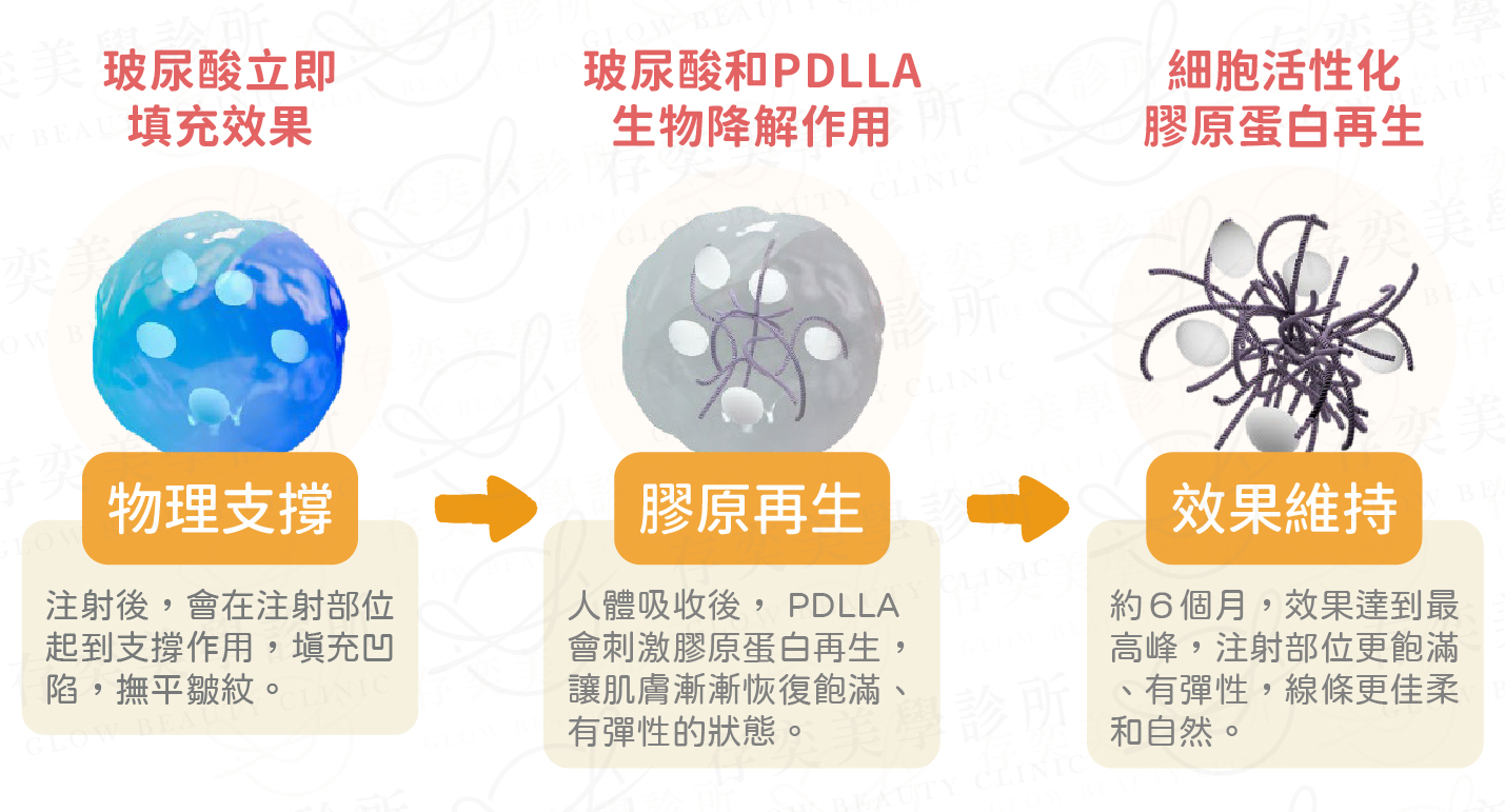 薇貝拉作用原理