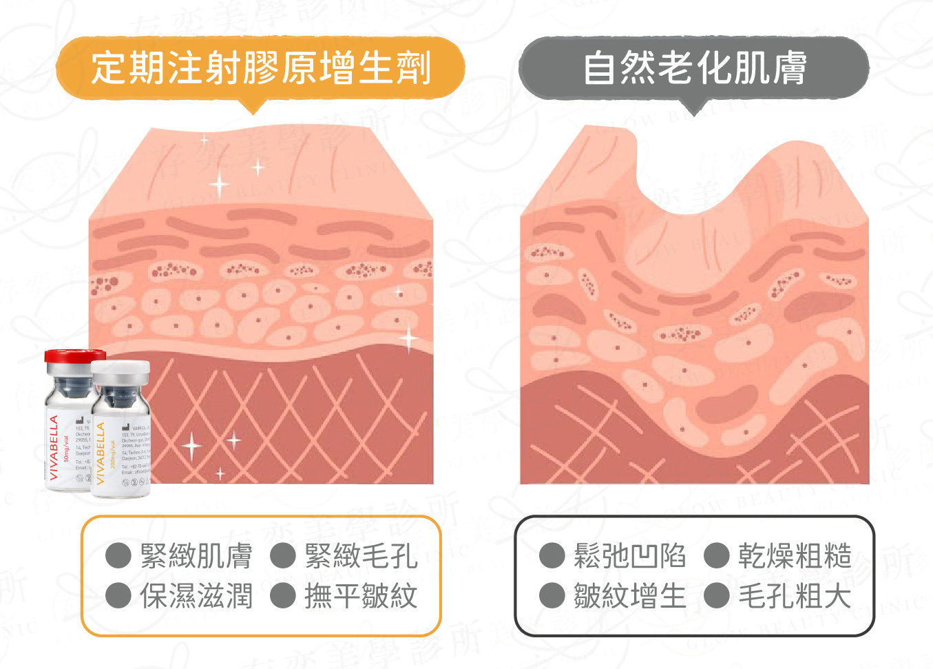 薇貝拉作用原理