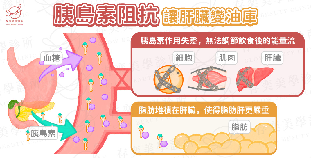 脂肪肝飲食禁忌-胰島素阻抗讓肝臟變油庫