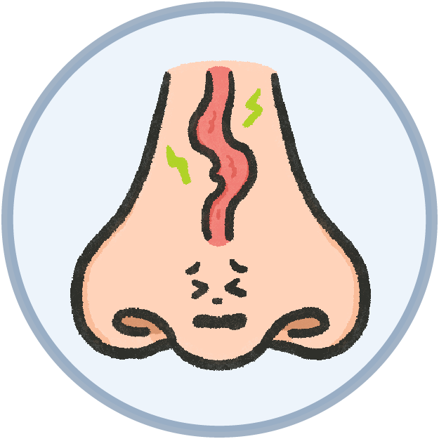 睡眠呼吸中止症猛健樂-導致打呼的常見原因_鼻腔通道異常