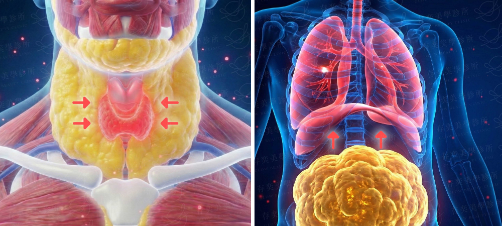 猛健樂改善睡眠呼吸中止症