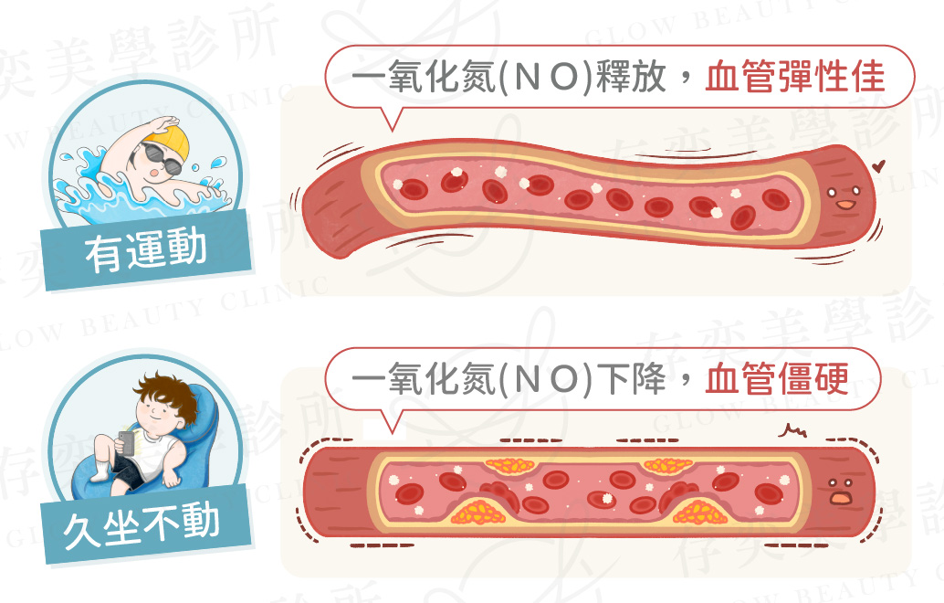血管阻塞7大原因B_久坐、缺乏運動