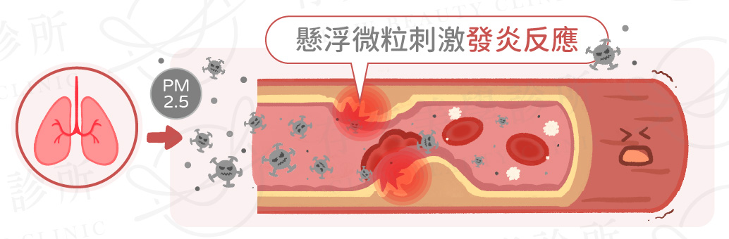 血管阻塞7大原因B_環境因素