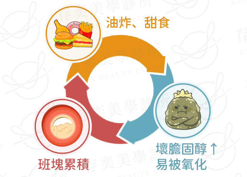 血管阻塞7大原因B_高油脂、精緻飲食習慣