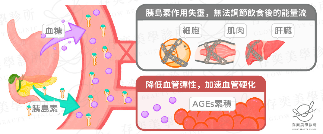 胰島素阻抗加速血管硬化2_工作區域 1