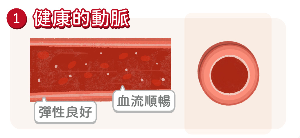 血管硬化是什麼4_健康的動脈