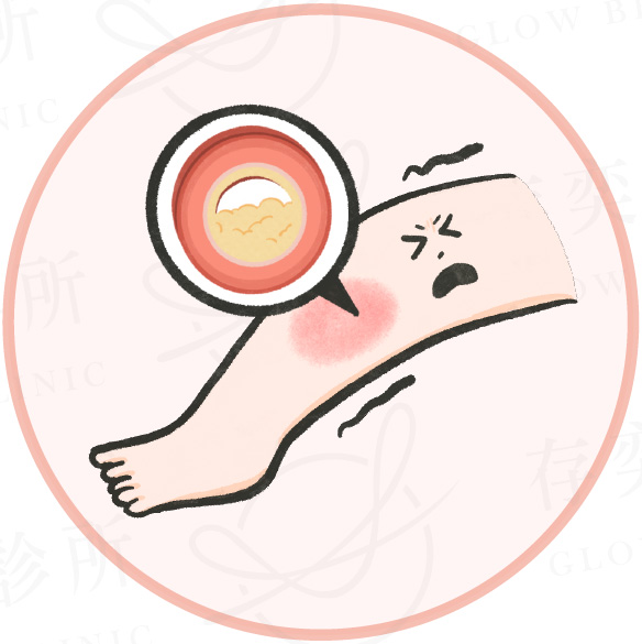 血管硬化的徵兆又哪些_足部血管-周邊動脈阻塞