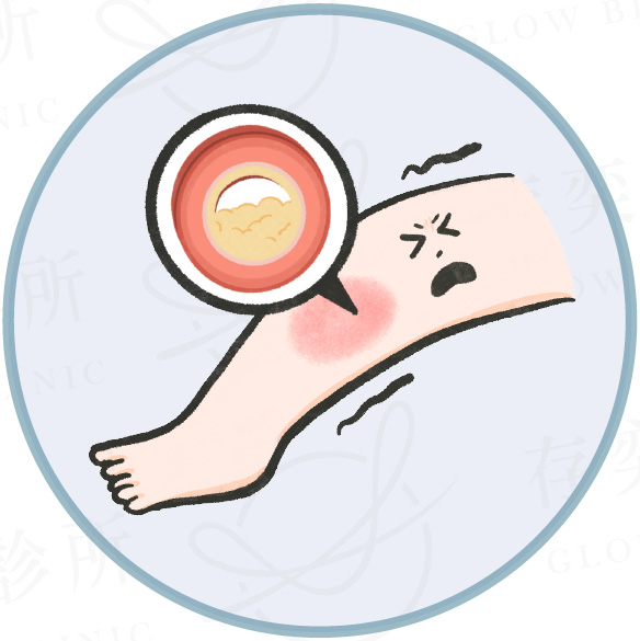 血管硬化的風險與影響_足部血管-周邊動脈阻塞