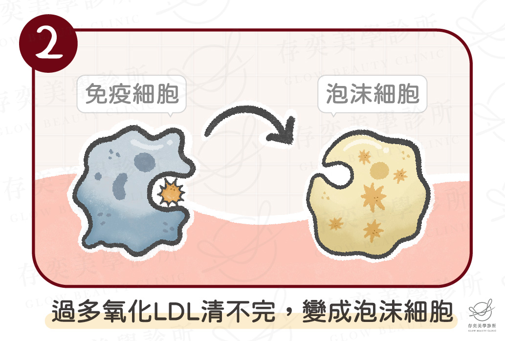 血管硬化4種原因-高血脂-02