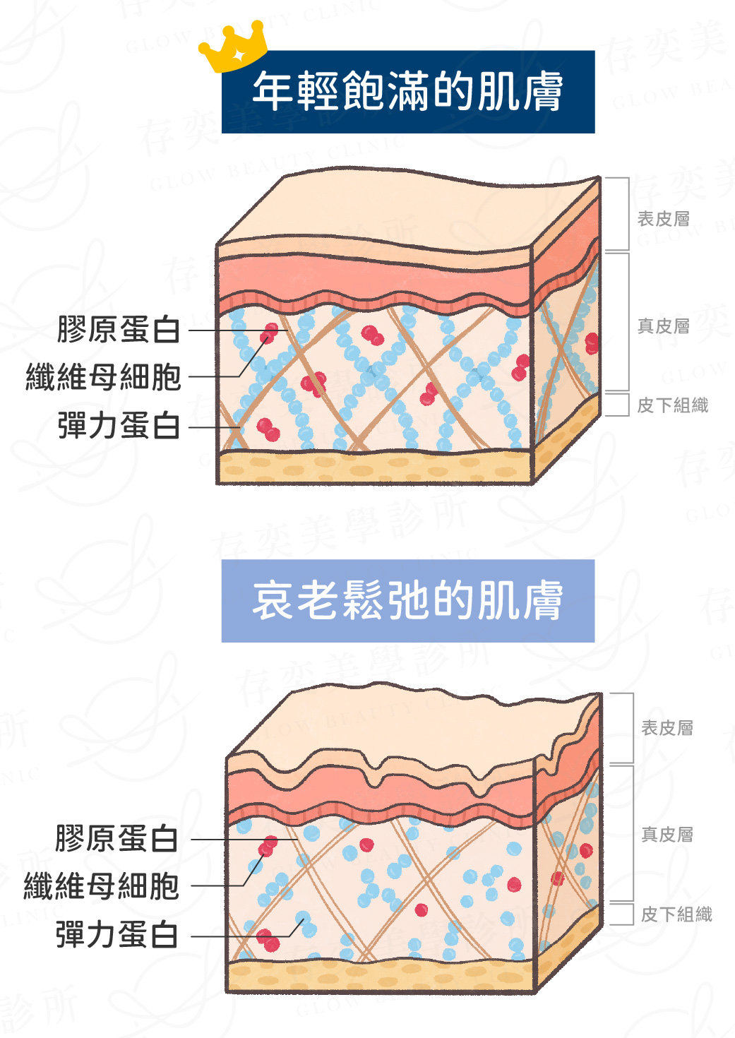 profhilo逆時針璞菲洛-年輕飽滿肌膚VS哀老鬆弛的肌膚_手機