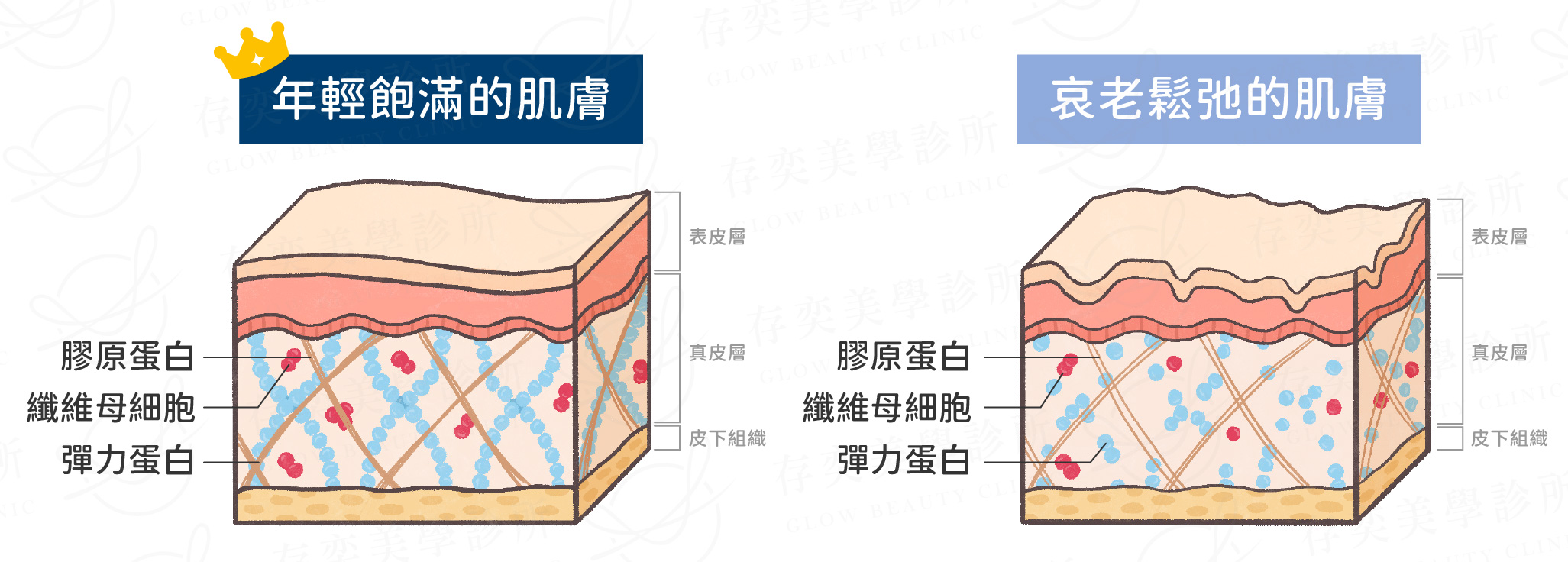 profhilo逆時針璞菲洛-年輕飽滿肌膚VS哀老鬆弛的肌膚_電腦
