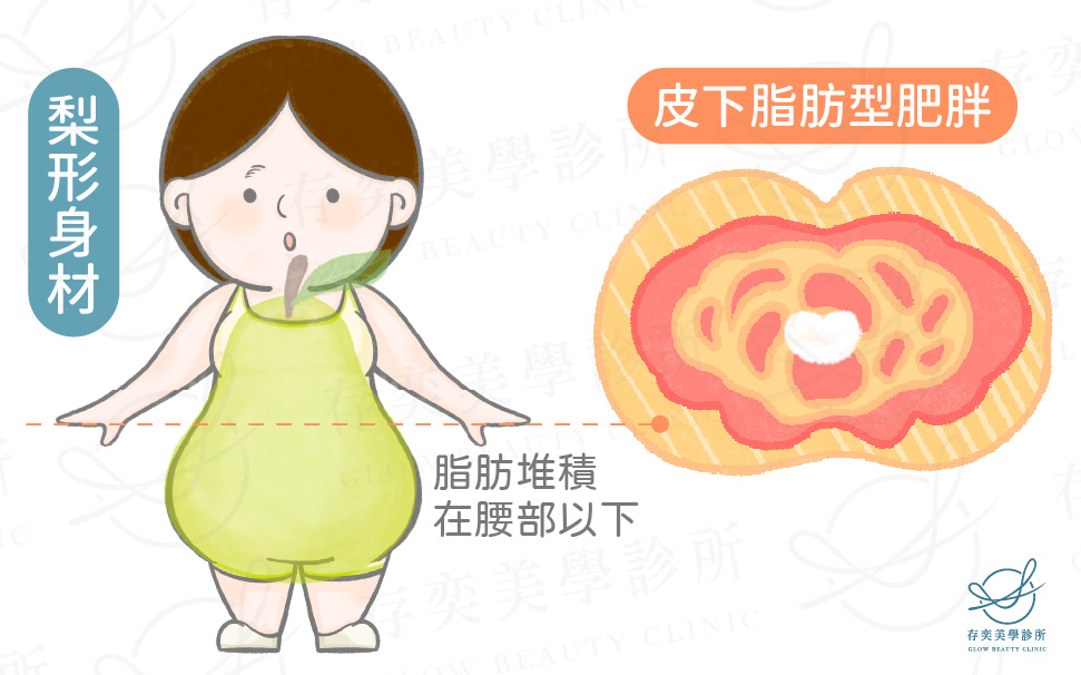 皮下脂肪型肥胖2_梨形身材