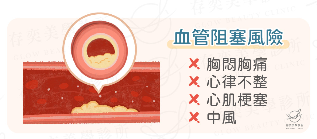 血管阻塞2_硬化的動脈