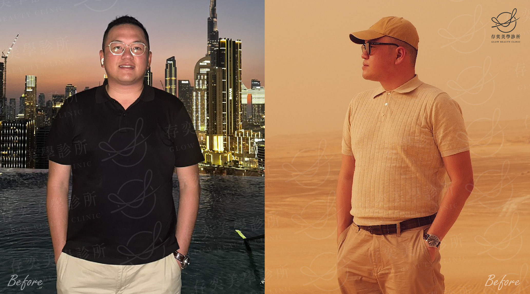 John減重_術前生活照A