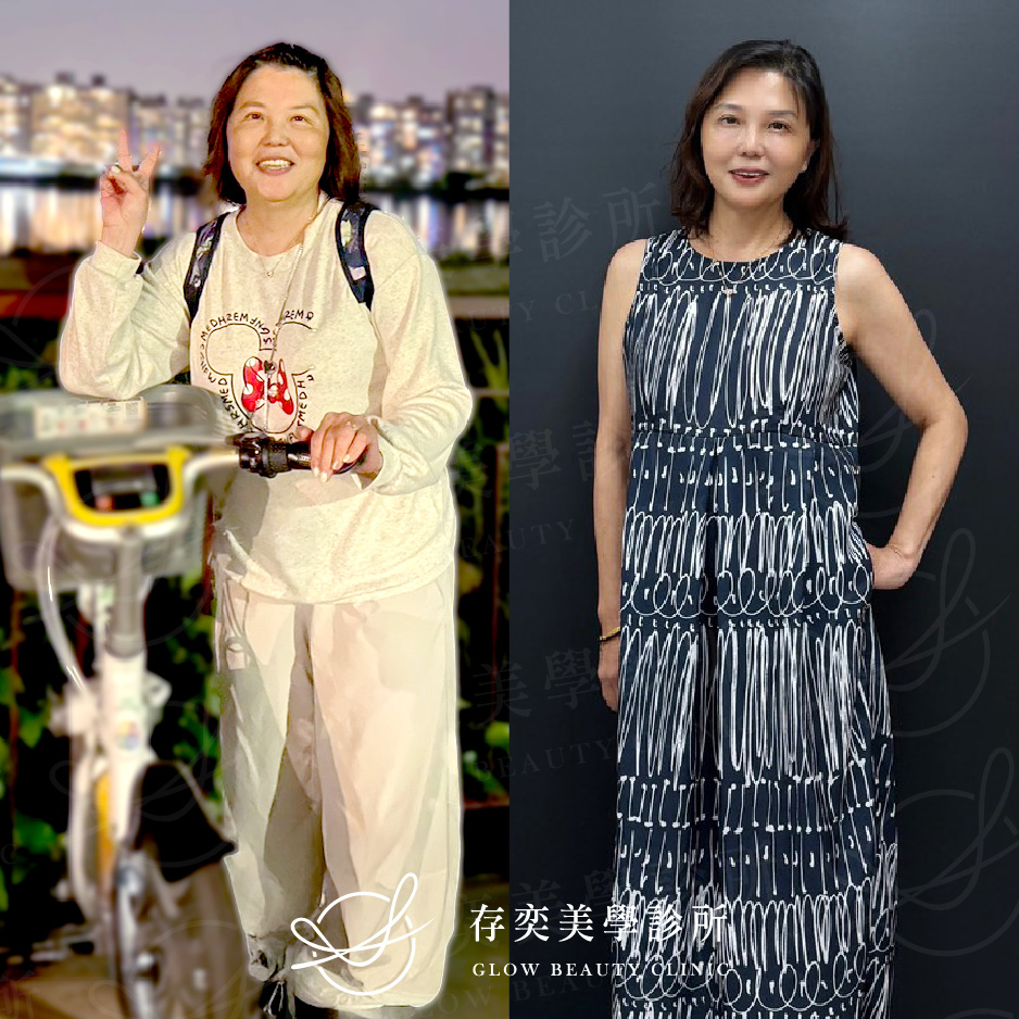 小方圖-顏安綺減重v2_02