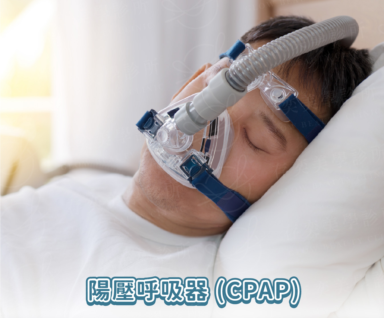 打呼很大聲怎麼改善-02