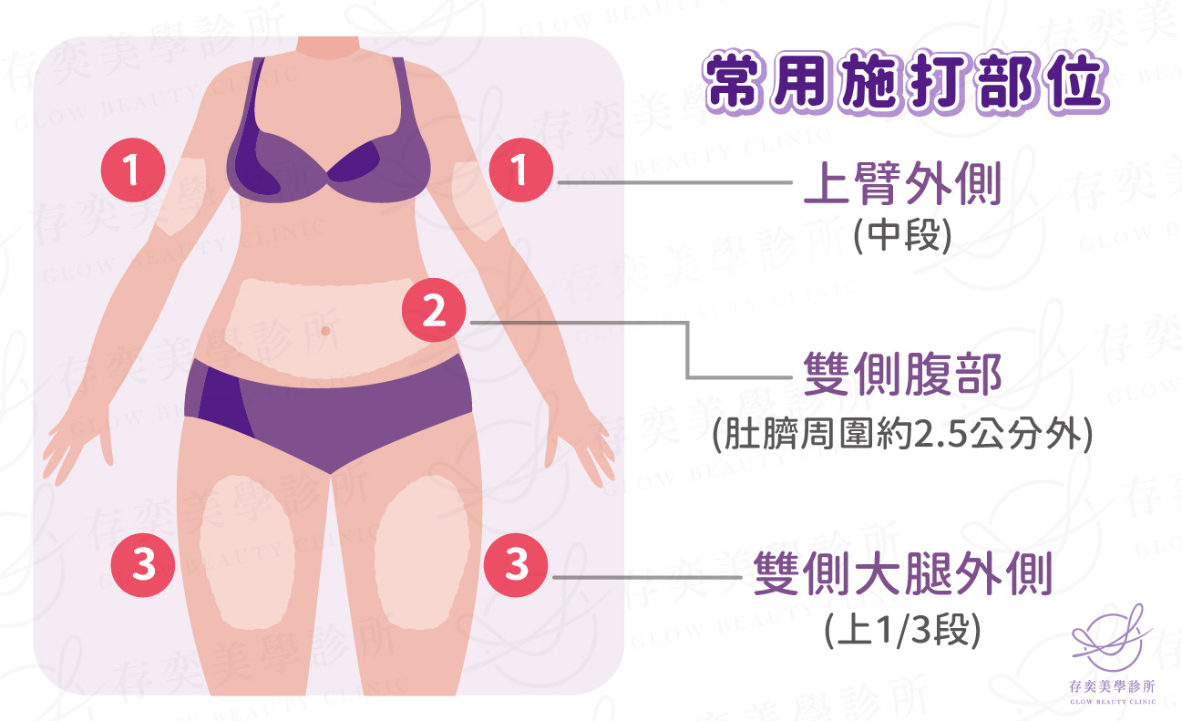 猛健樂打法與施打位置2-01