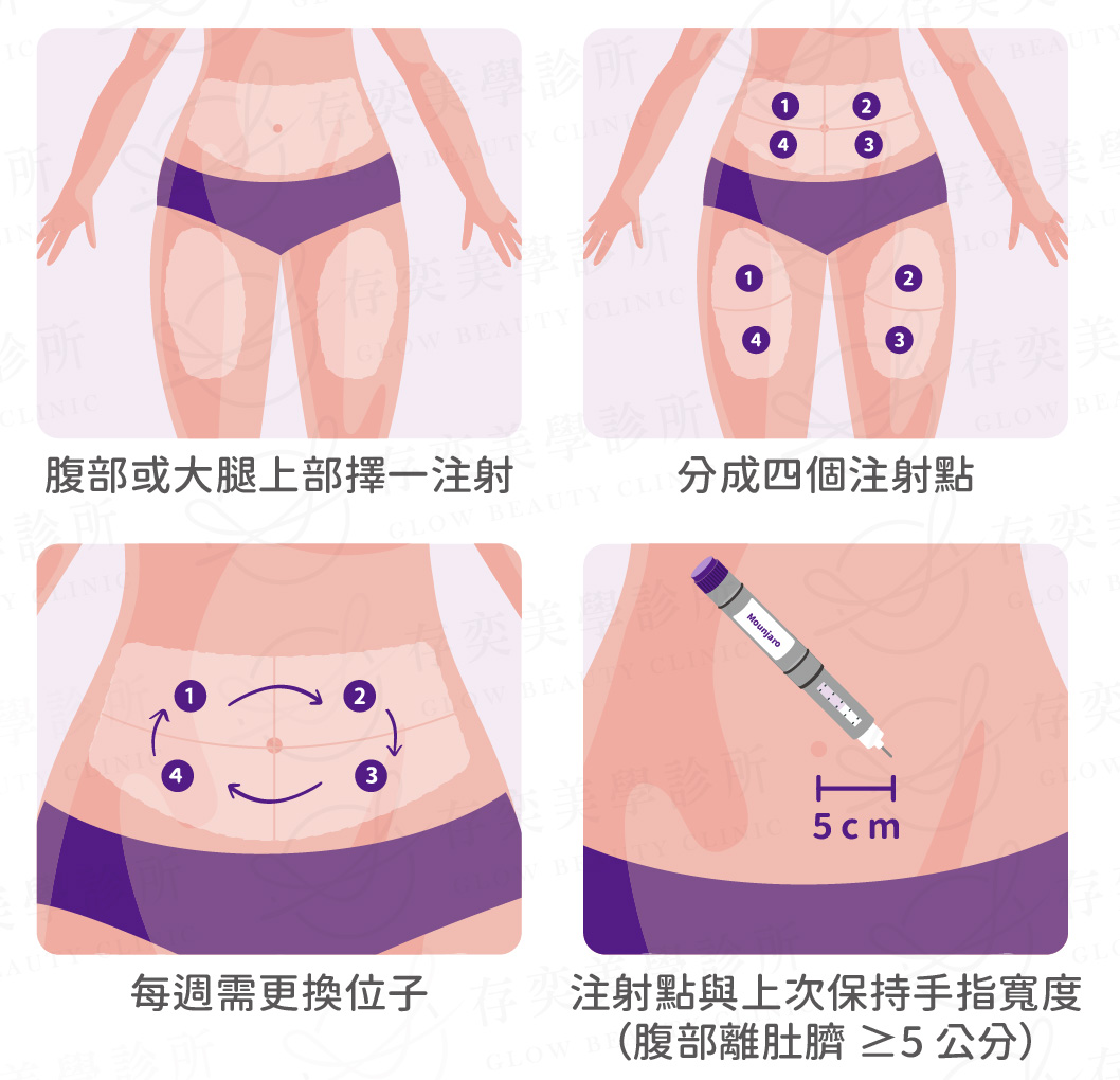 猛健樂打法與施打位置3-02