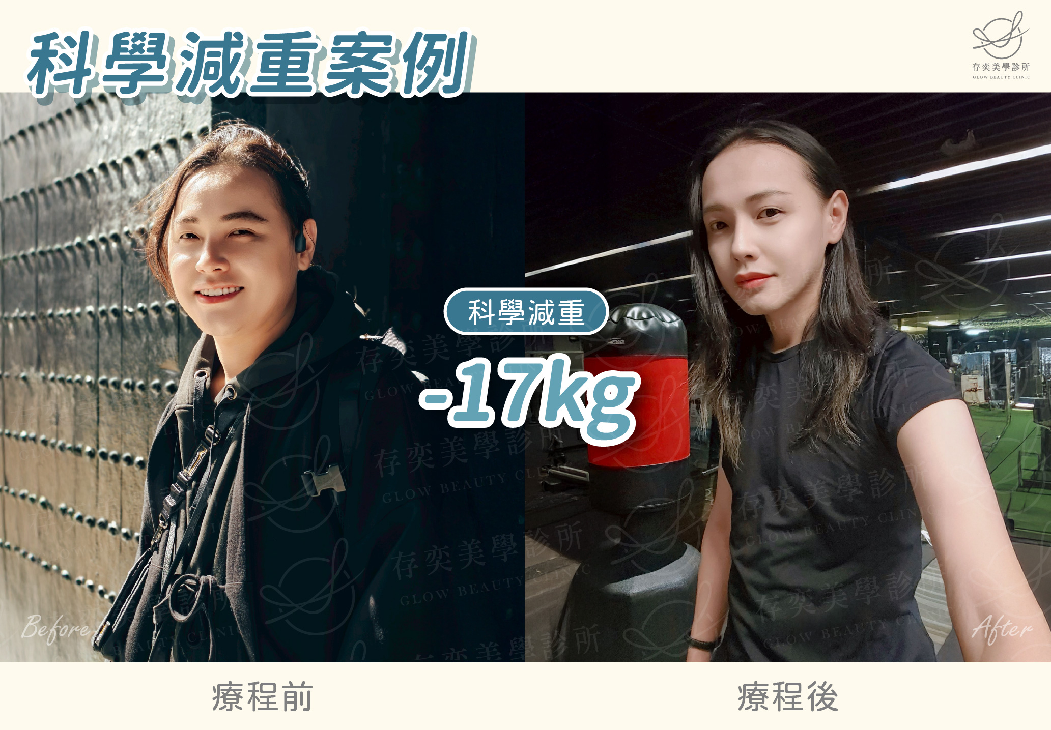 小艾減重BA-體重減17公斤