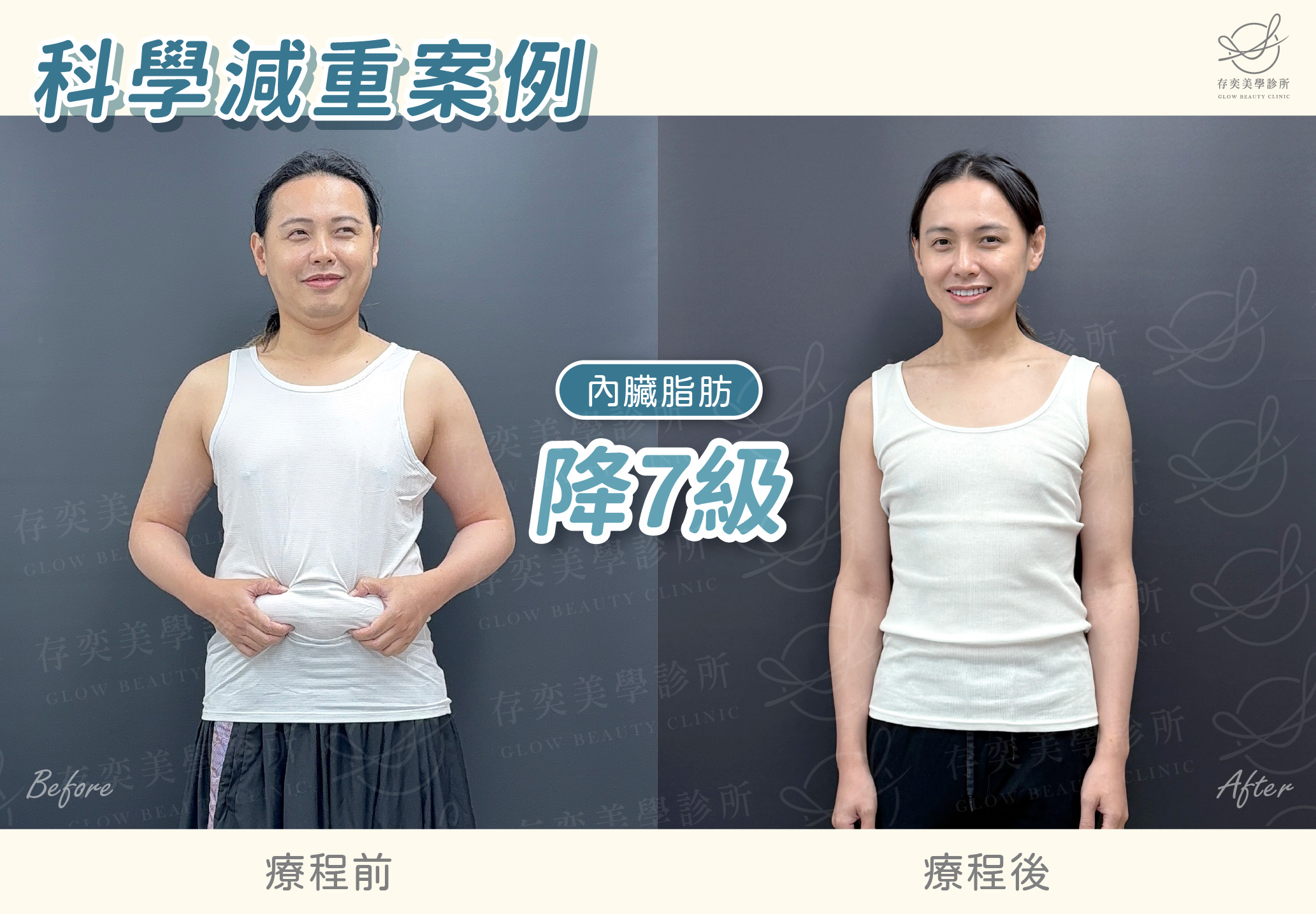 小艾減重BA.-內臟脂肪降7級