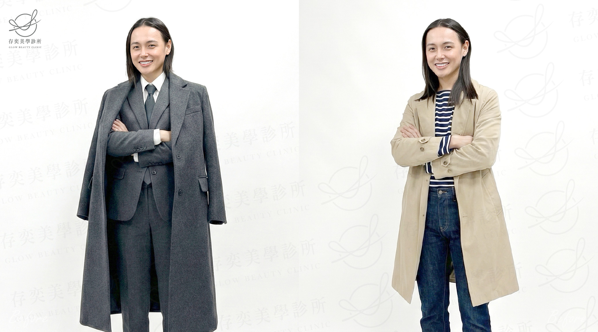 小艾減重_術後生活照A