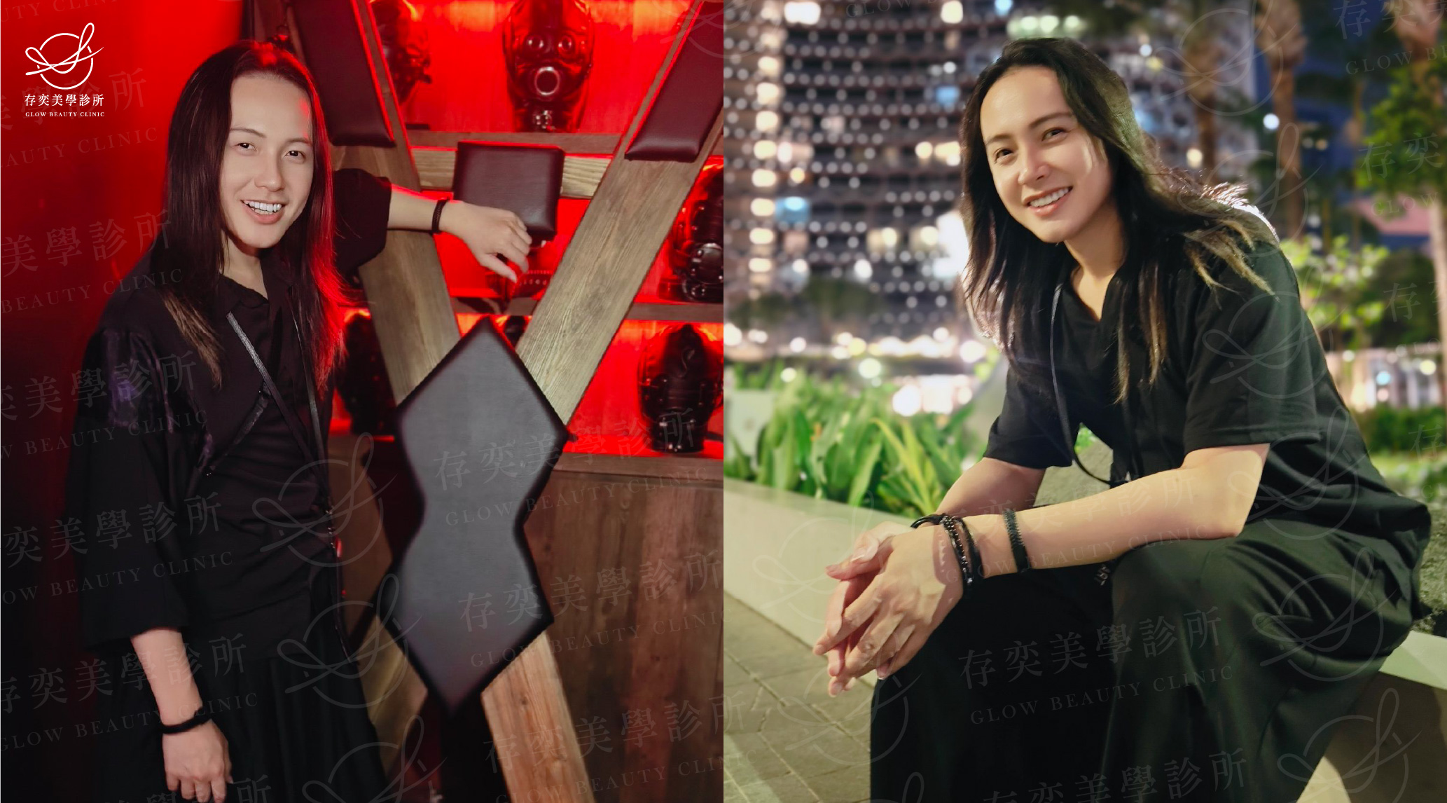 小艾減重_術後生活照B2