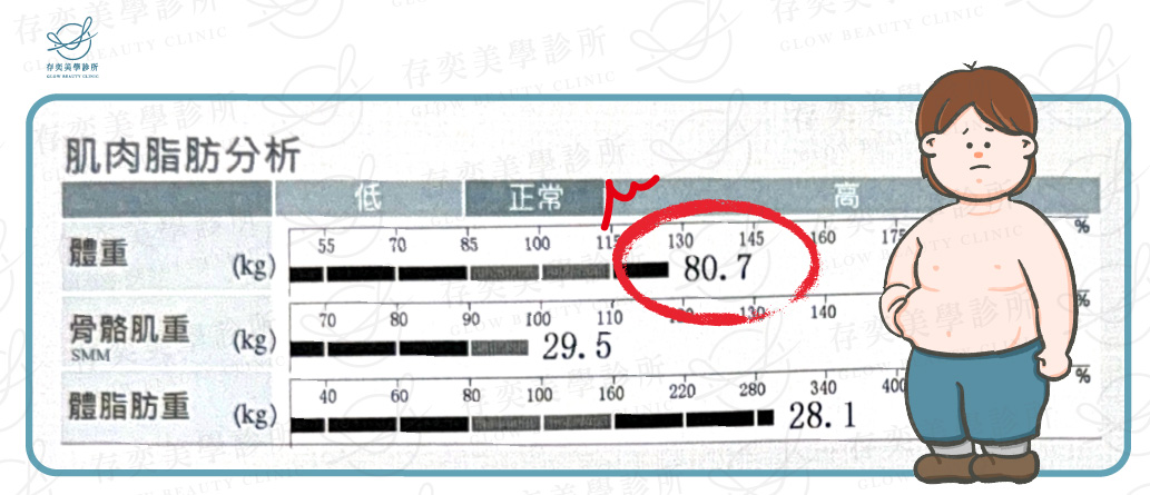 小艾 inbody數據圖_術前v3_術前