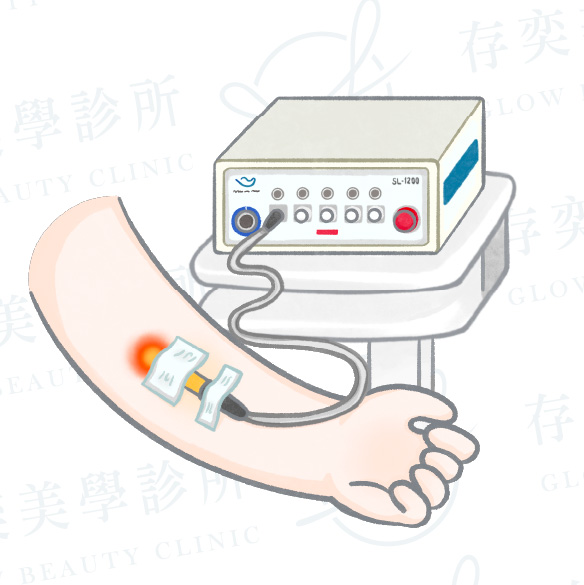 存奕美學如何協助調整自律神經_ILIB靜脈雷射