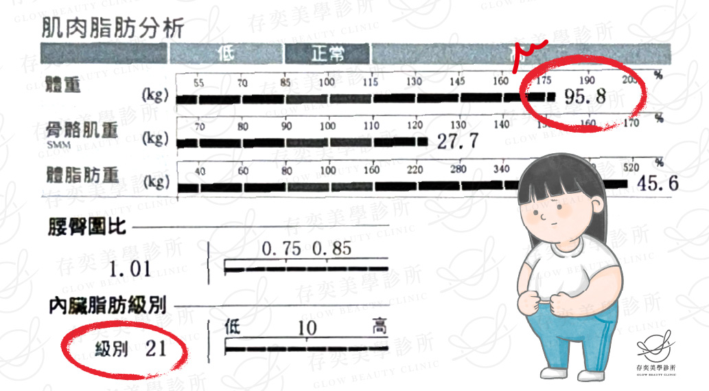 愛麗絲 inbody數據圖v2_術前