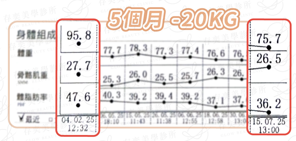 愛麗絲 inbody數據圖v6_術後