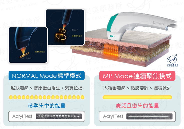 優勢3-MPT微脈衝技術V6_手機