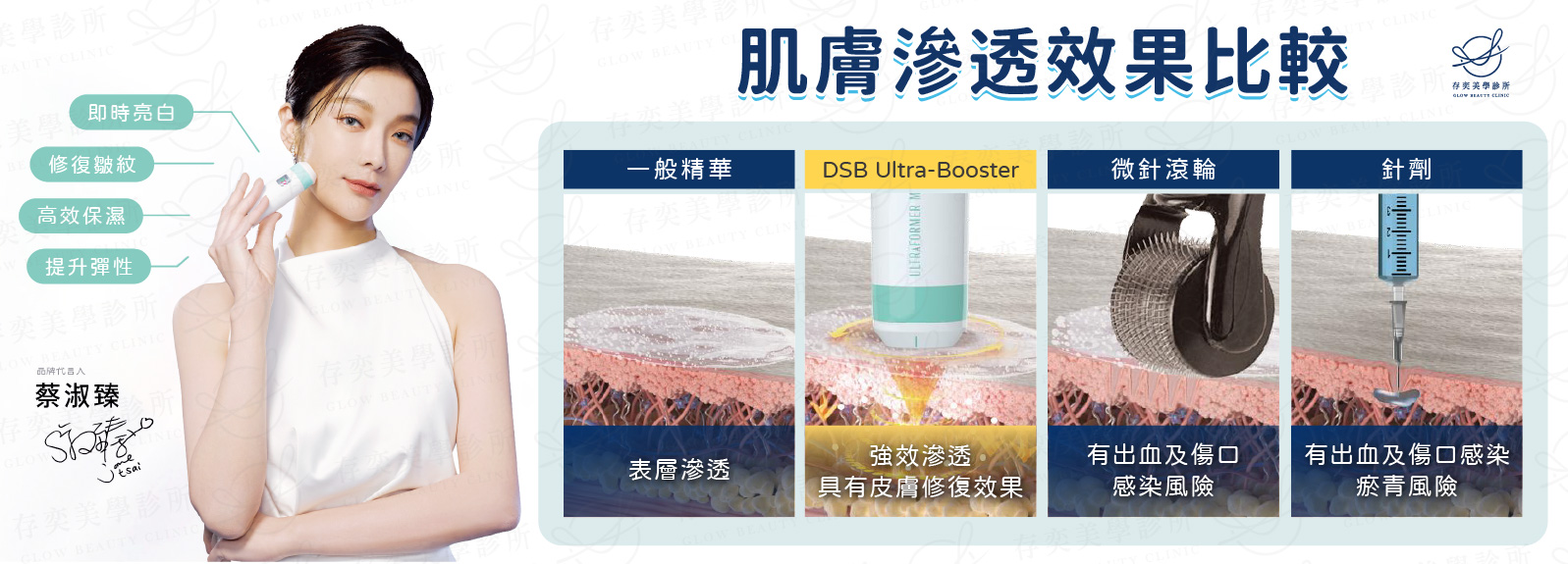 優勢4-精華超音波導入V8
