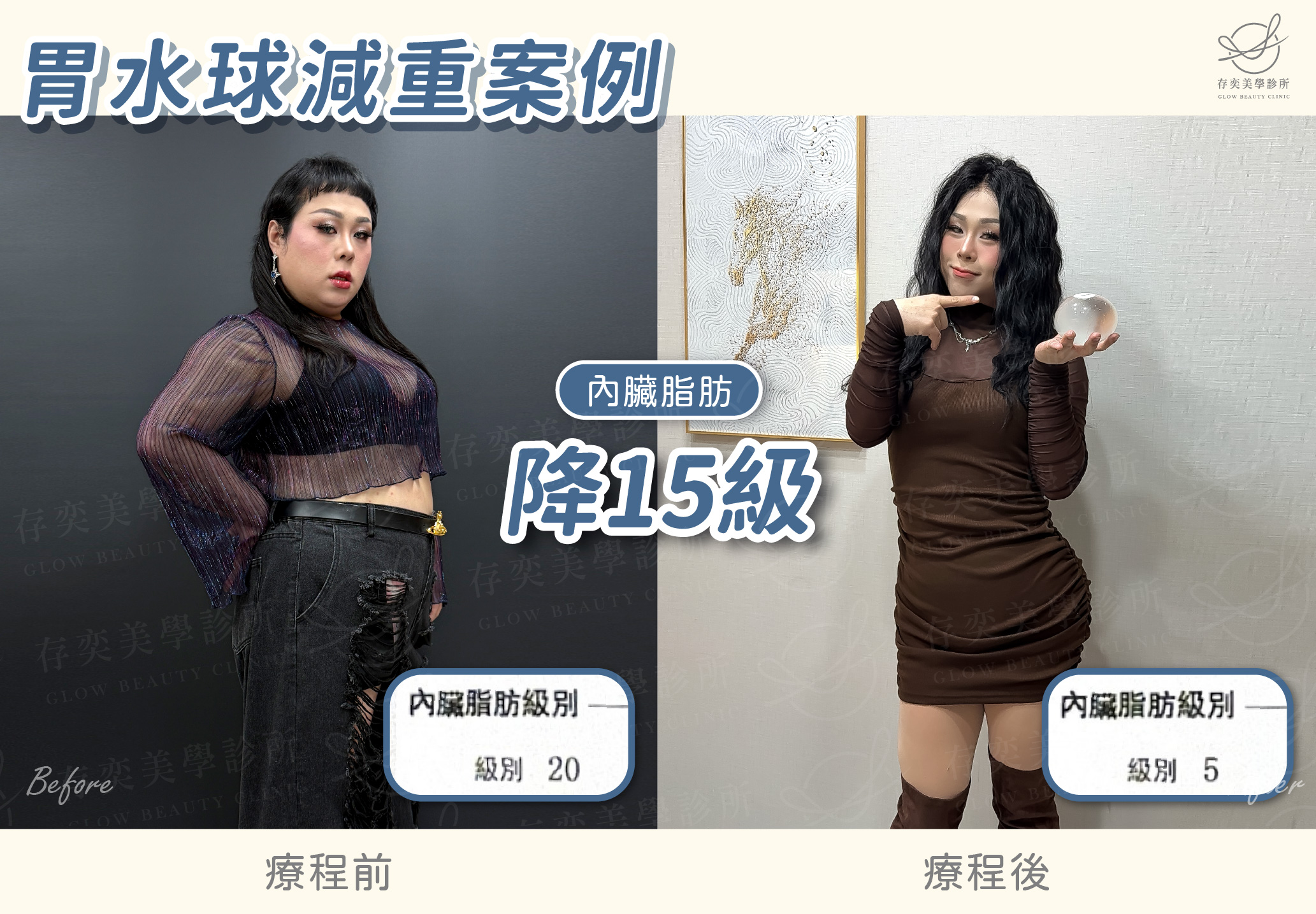 陳璽安減重BA-內臟脂肪v3