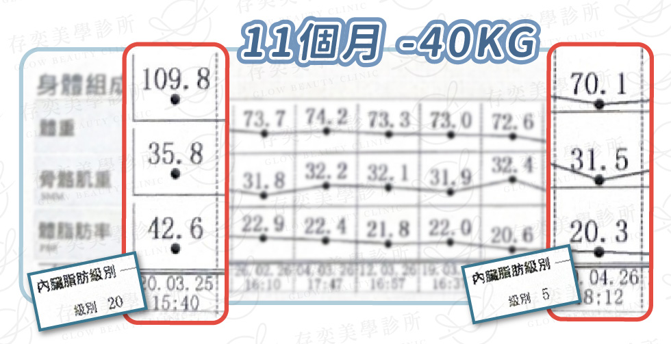 陳璽安 inbody數據圖_術後