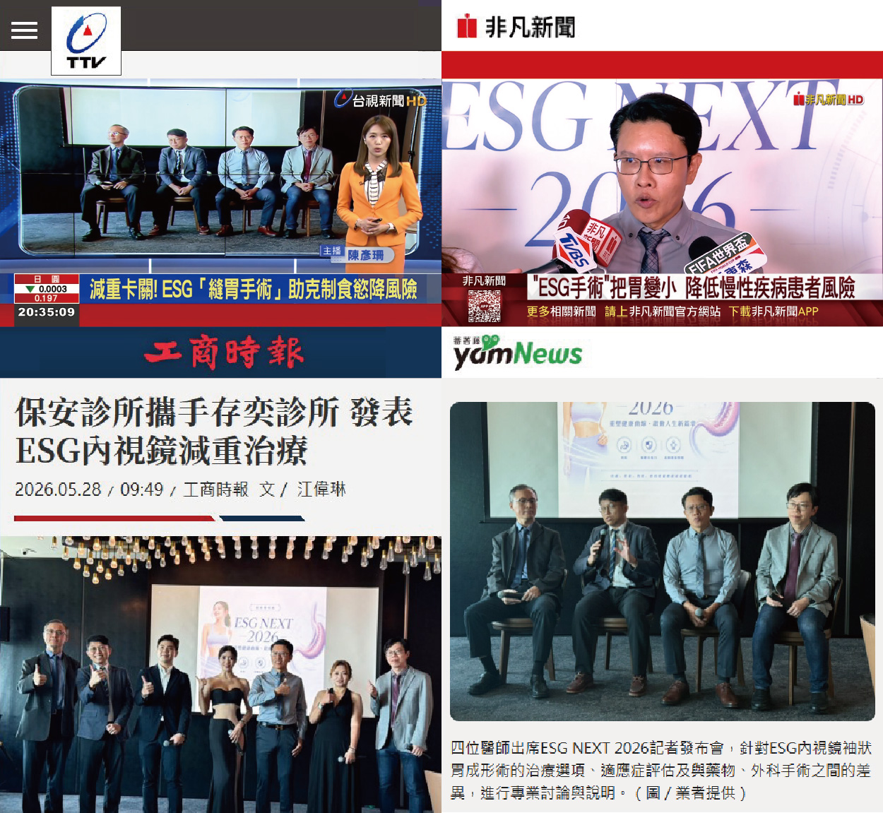 ESG胃縫合記者會