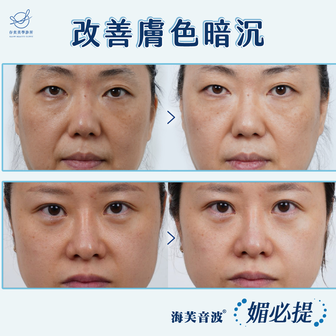 媚必提_改善膚色暗沉