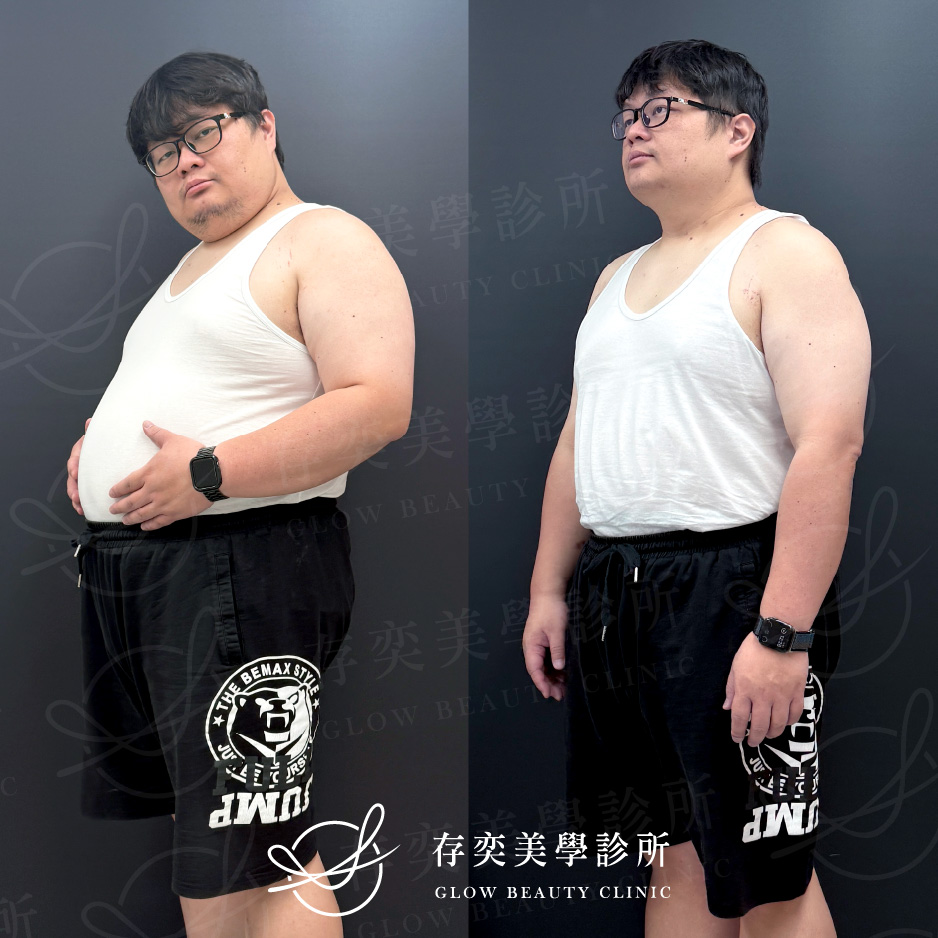 小方圖-林玟圻減重_02