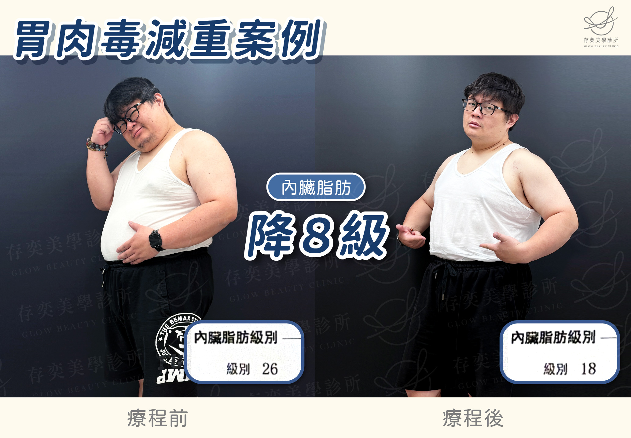 林玟圻減重BA-內臟脂肪降8級v3