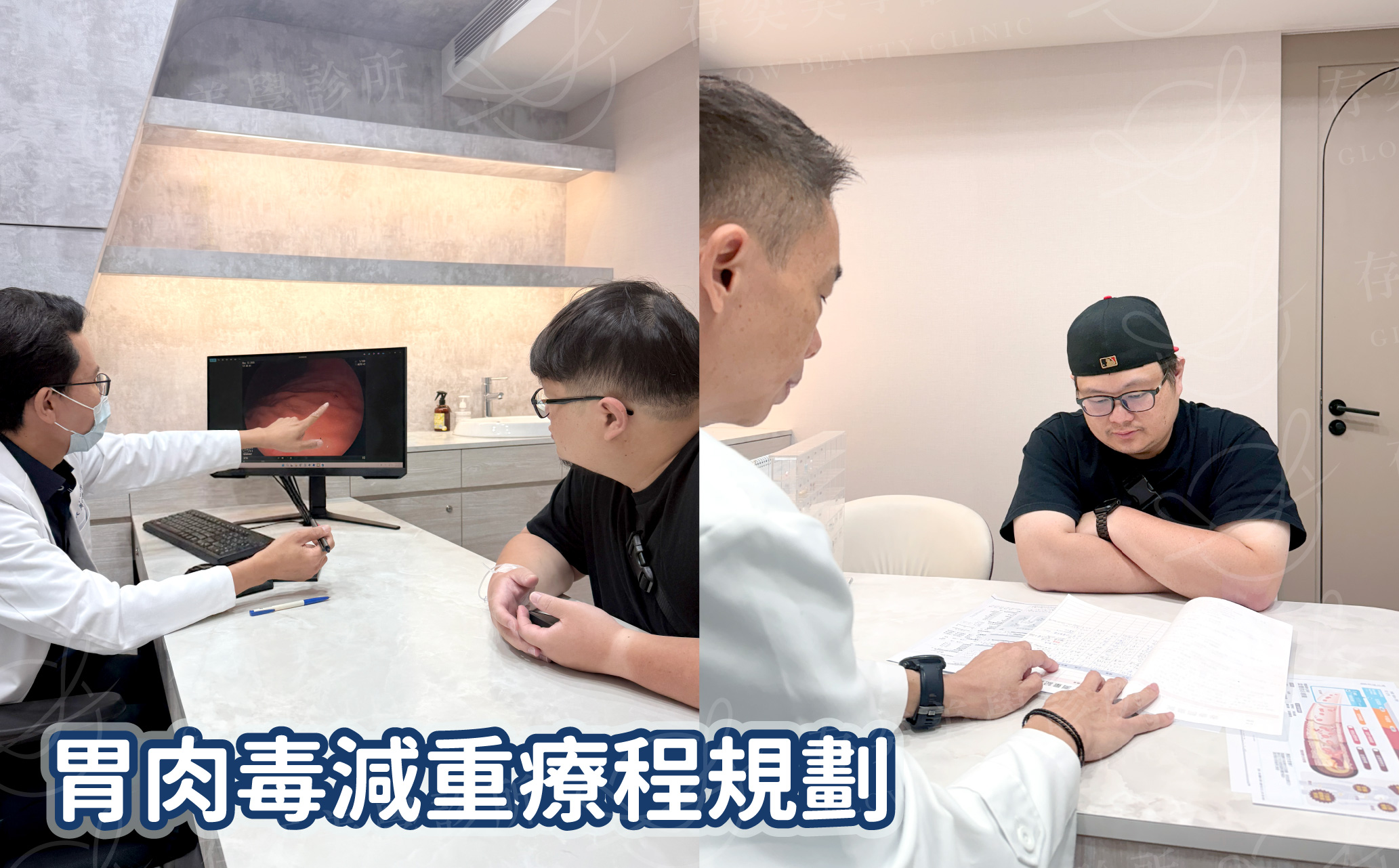 林玟圻減重_胃肉毒減重療程規劃