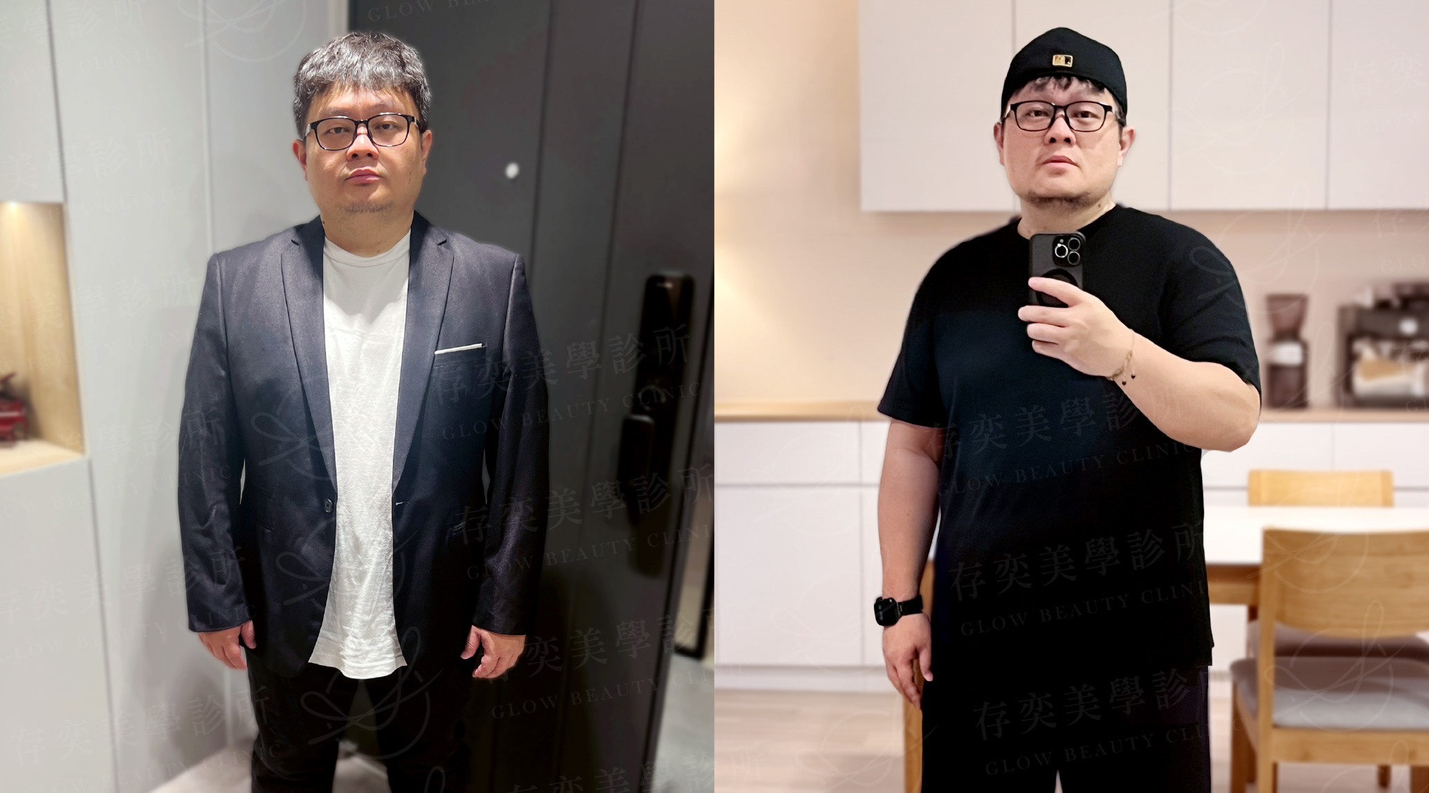 林玟圻減重_術後生活照Bv3