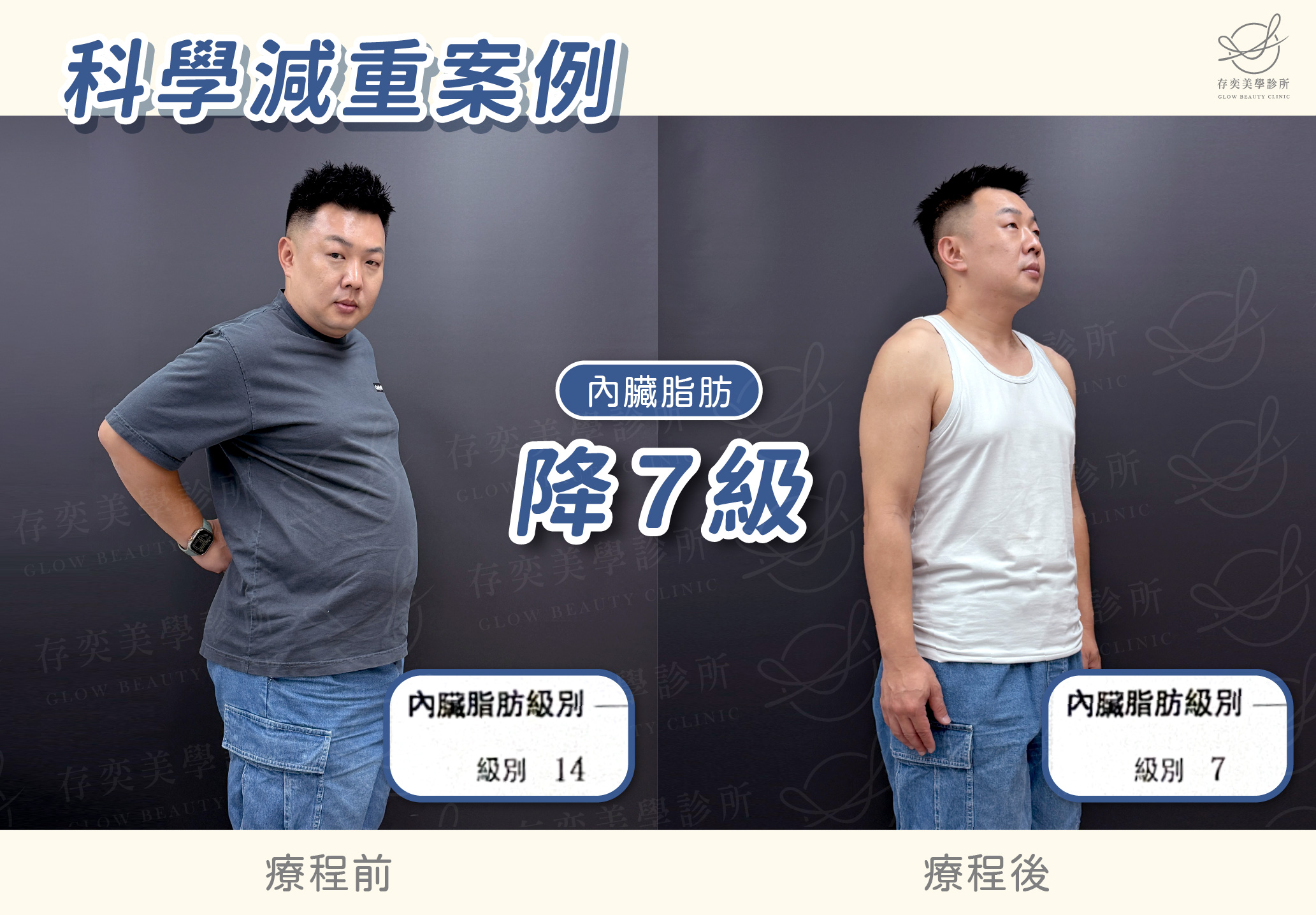 老馮減重BA-內臟脂肪降7級