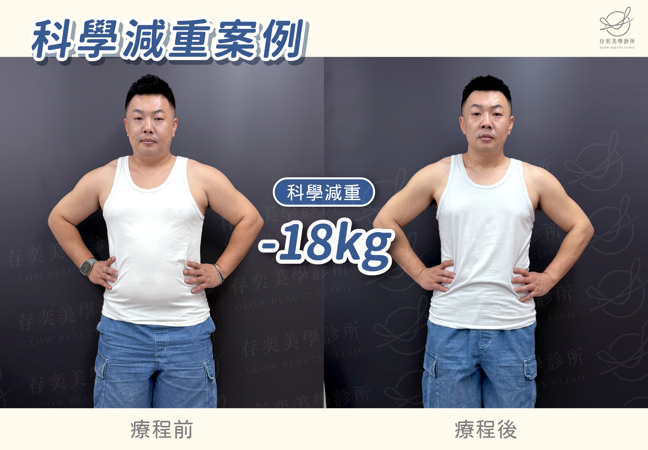 老馮減重BA-減18公斤
